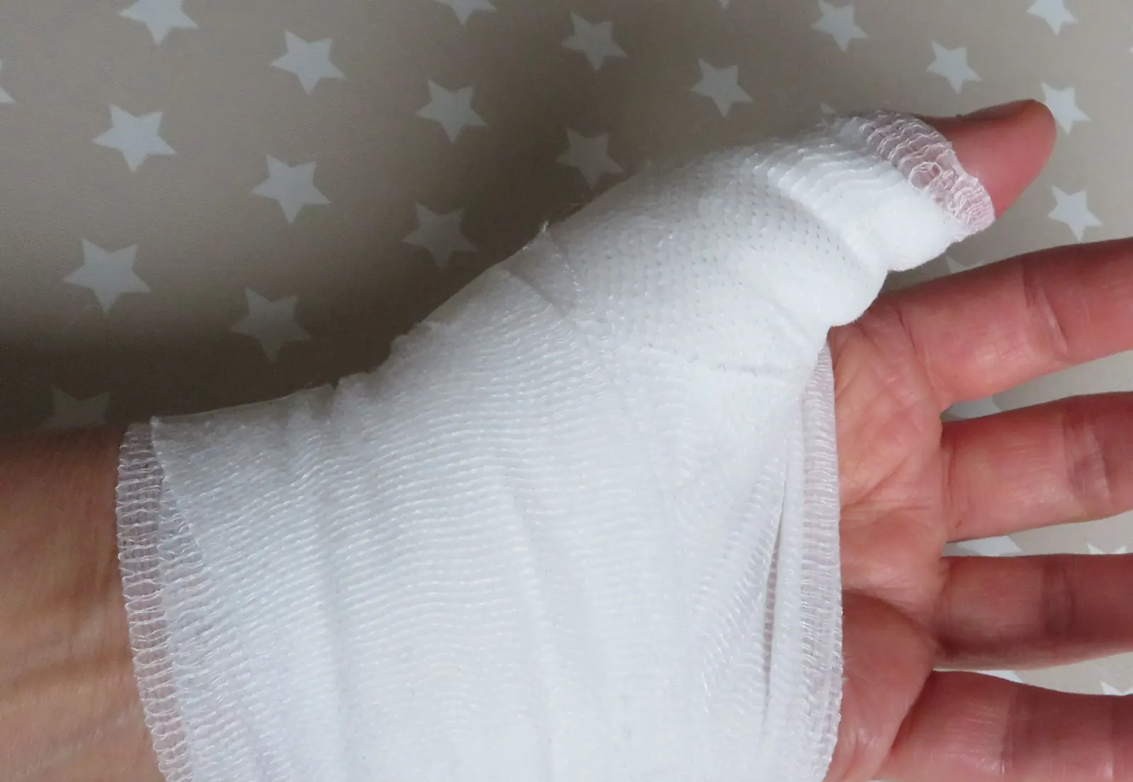 Main et pouce recouverts d'un bandage de gaze blanc